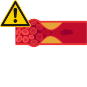 trombose.png